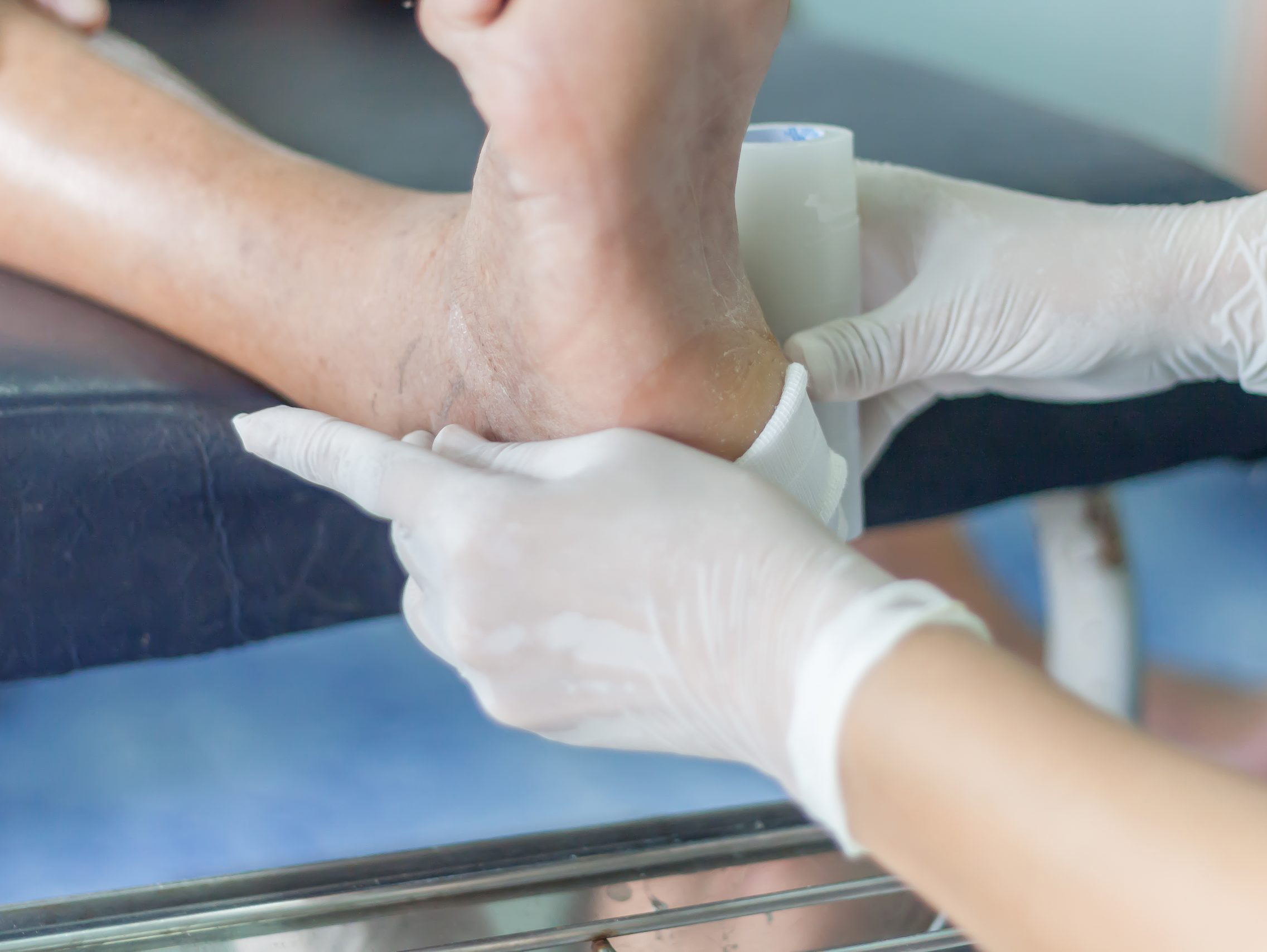 Diabetic Foot Care at Dr Singh’s City Hospital in Kalamboli: Expert Treatment and Prevention