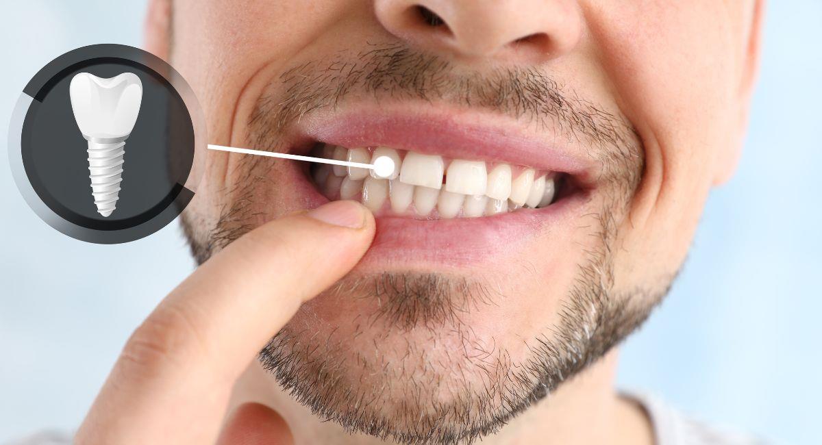 Dental Implants: The Ideal Solution for Missing Teeth – Dr. Singh’s City Hospital, Kalamboli